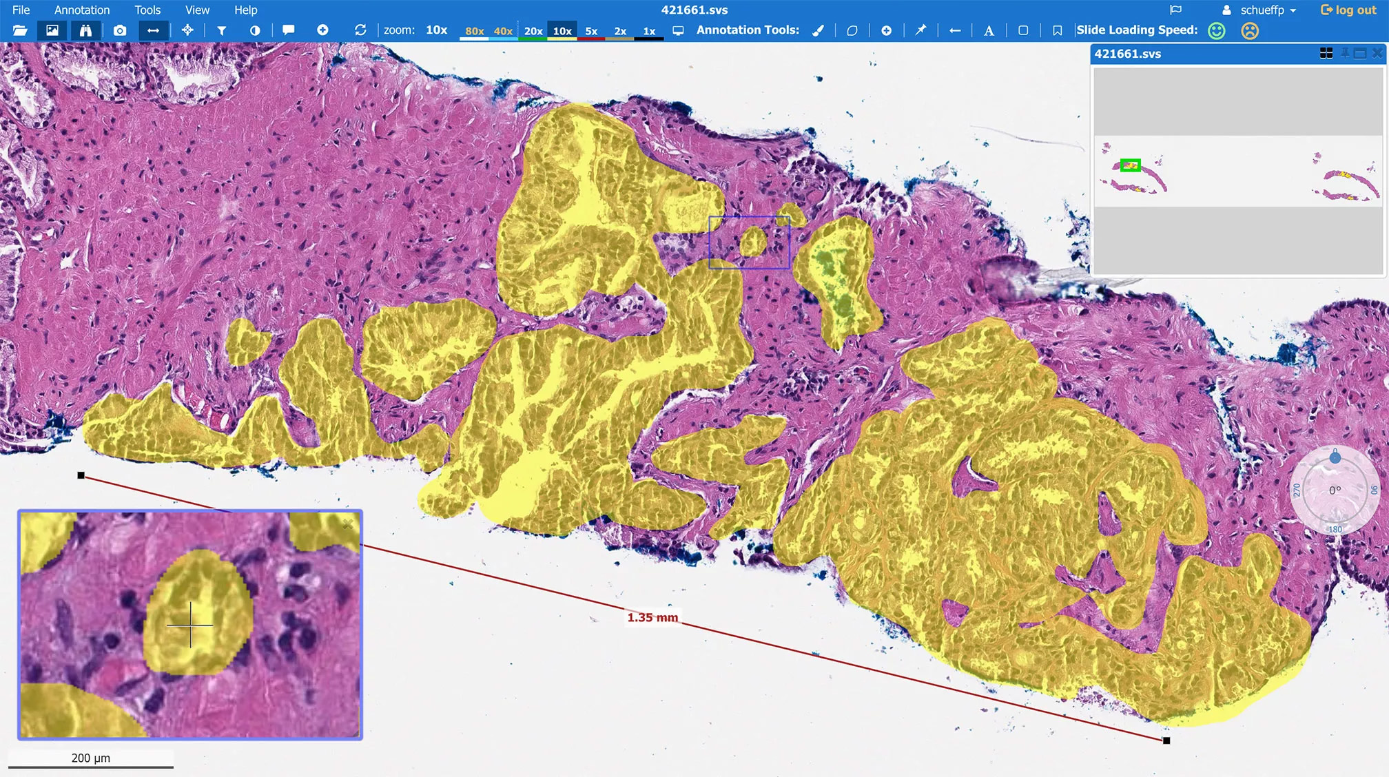 Integrated Digital Pathology