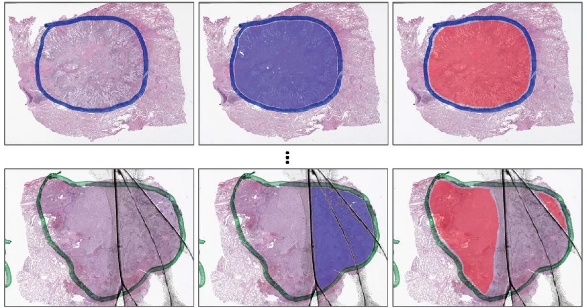 Digital Molecular Pathology